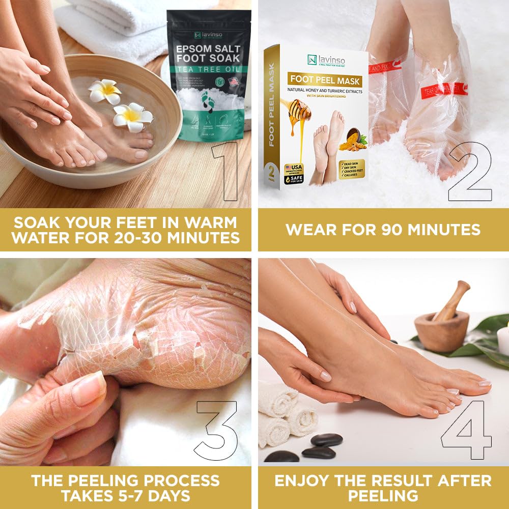 Lavinso Honey Feet Peeling Mask for Dry Cracked Feet - 4 Pack - with Kojic Acid Skin Brightening Effect - Exfoliating Dead Skin and Calluses - Foot Peel Mask for Baby Soft Feet