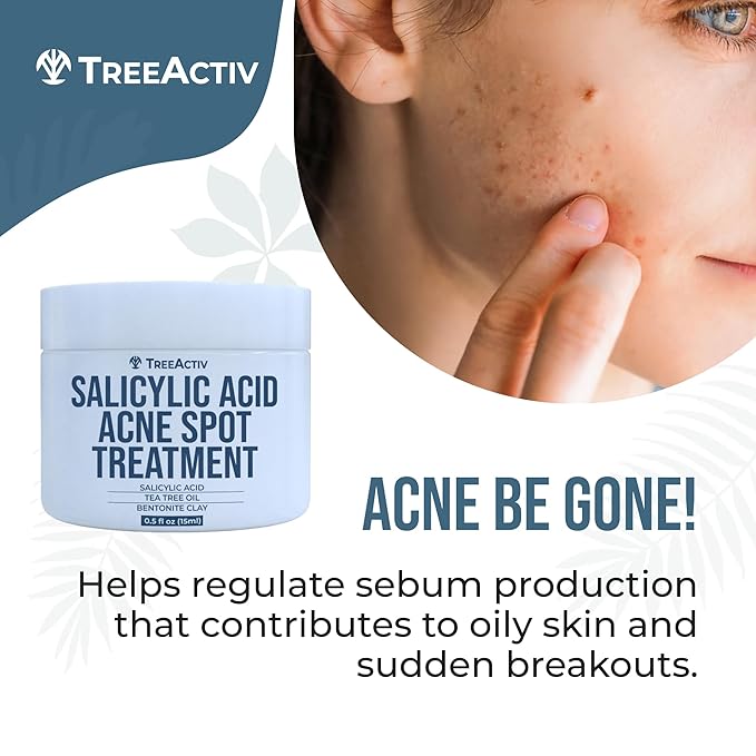 TreeActiv Invisible Acne Spot Treatment, 150+ Treatments, Salicylic Acid & Tea Tree Oil No Show Spot Treatment for Cystic & Hormonal Acne, Works for Blackheads & Whiteheads